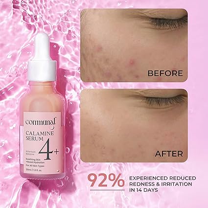 COMMUNAL CALAMINE SERAM 30ML