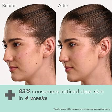 LOTUS HERBAL BOTANICS KOJIC ACID CREME 50GM