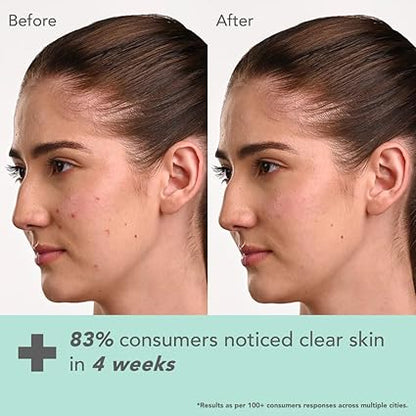 LOTUS HERBAL BOTANICS KOJIC ACID CREME 50GM