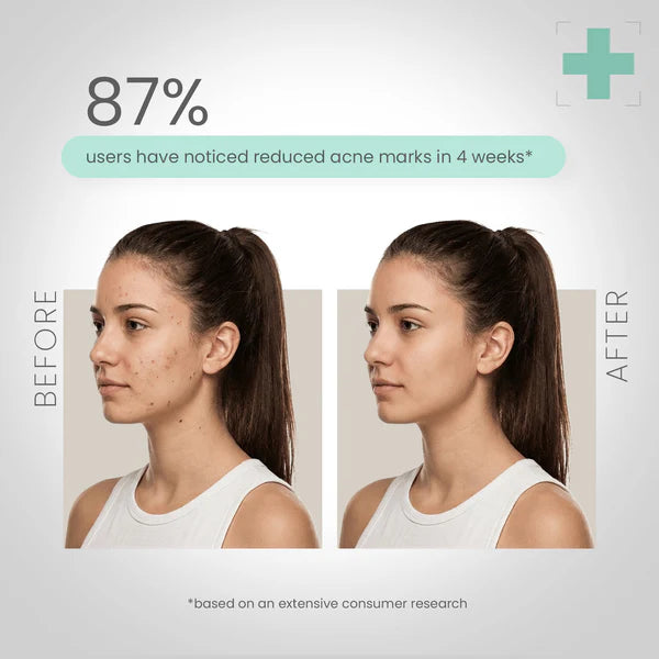 LOTUS HERBAL BOTANICS HI-DOSE SERUM 28ML